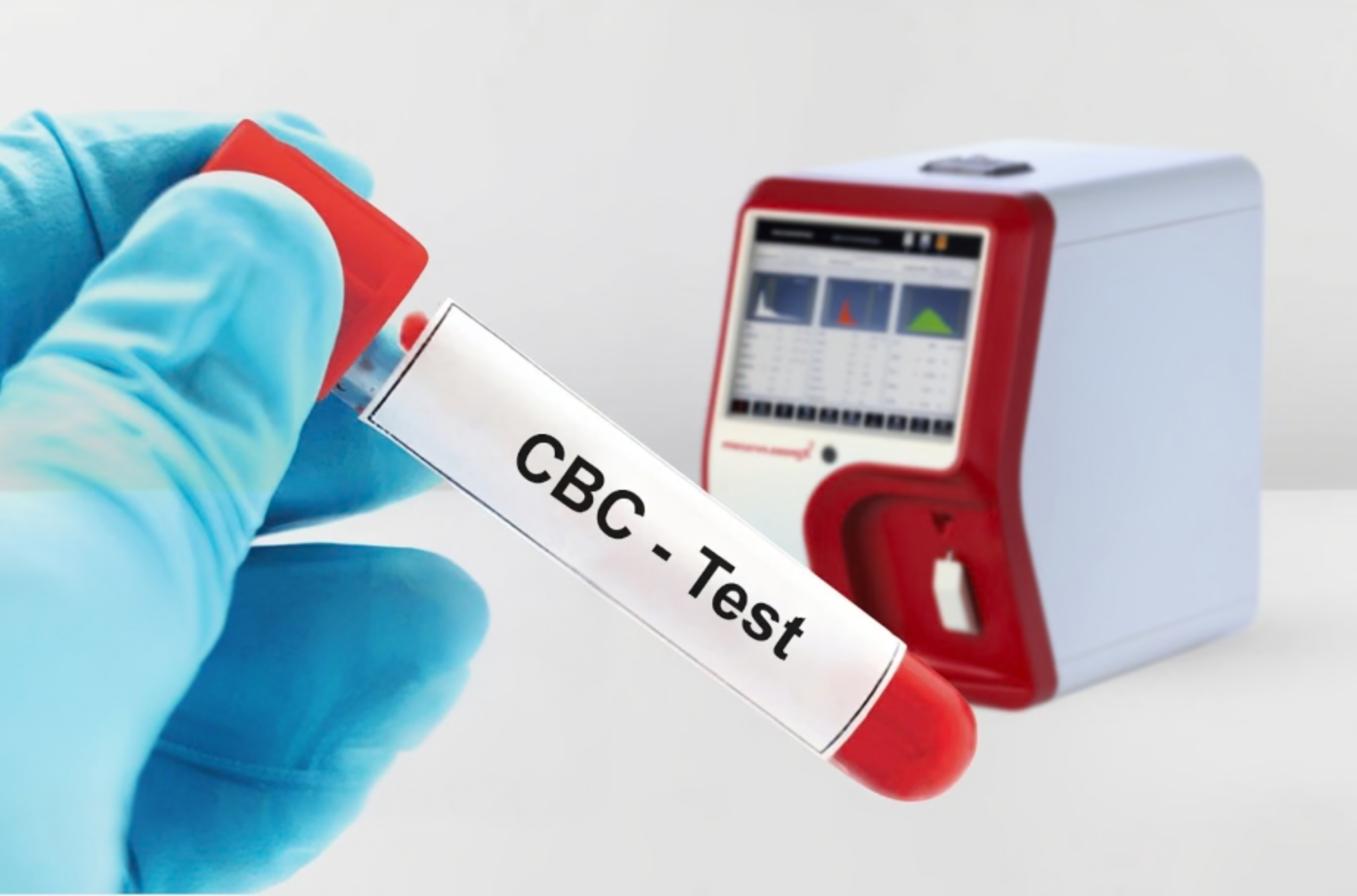 Decoding Your CBC: Why Your Blood Report Is the Ultimate Mirror of Your Health